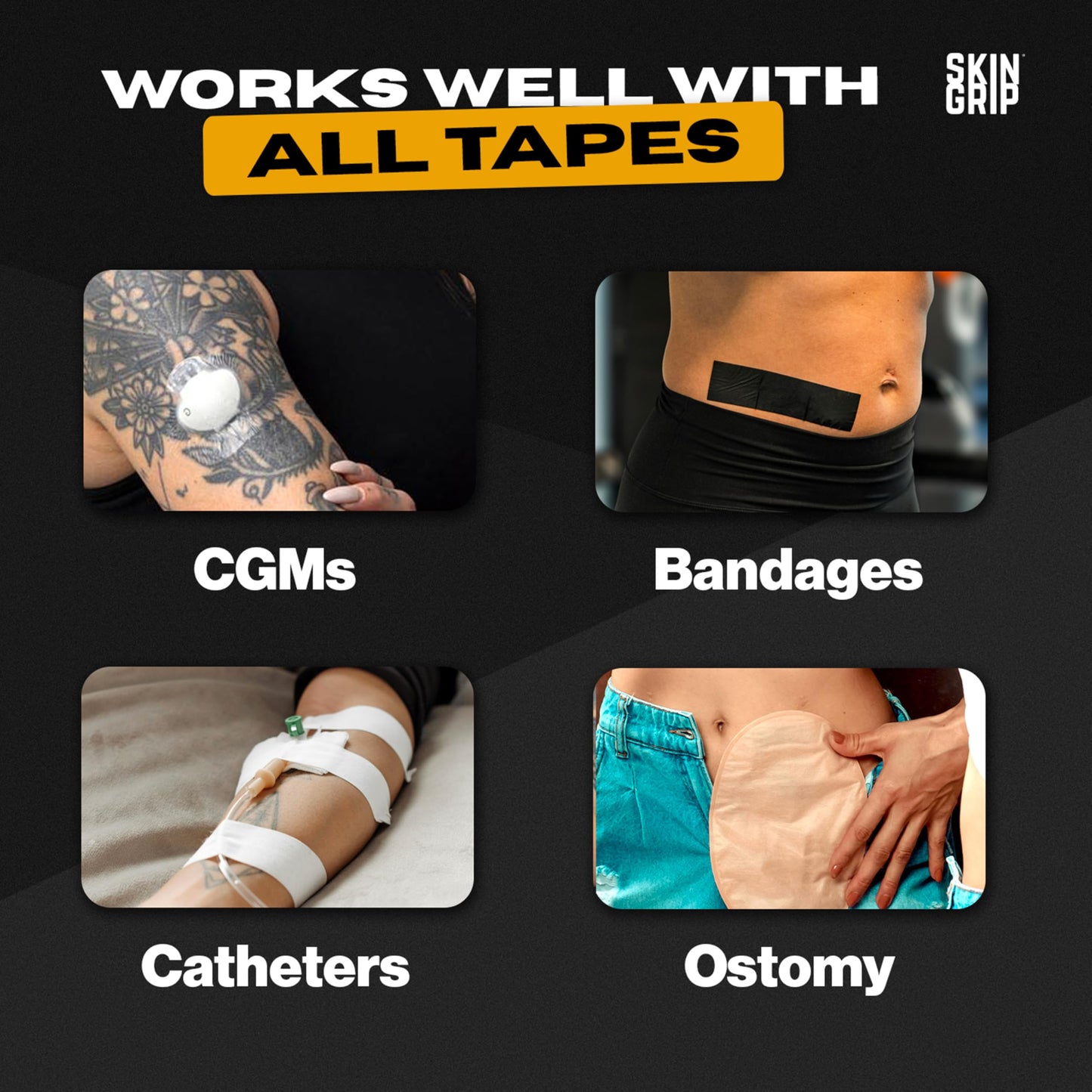 Skin Grip Adhesive Barrier Wipes – 50 Wipes for CGM, Ostomy & Wound Care