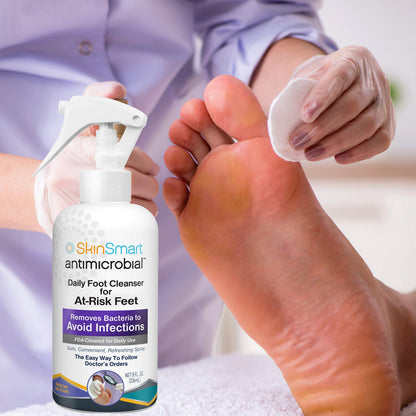 SkinSmart Daily Foot Cleanser – 8 oz Spray for At-Risk Feet | Doctor-Recommended