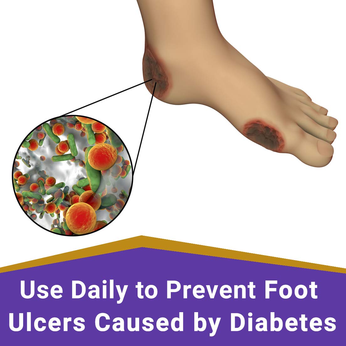 SkinSmart Daily Foot Cleanser – 8 oz Spray for At-Risk Feet | Doctor-Recommended
