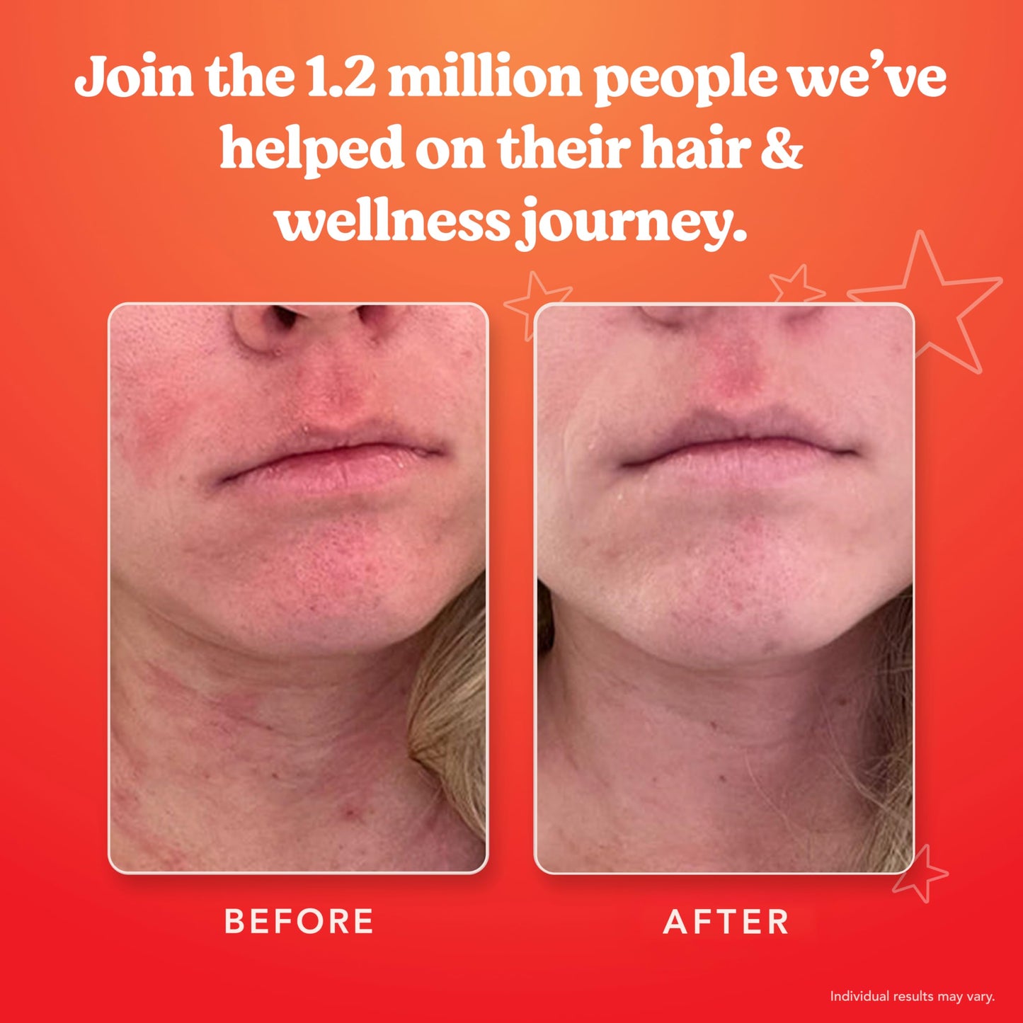 SKINtamin Vegetarian Collagen Pills | Skin Firmness, Wrinkles & Blemish Reduction