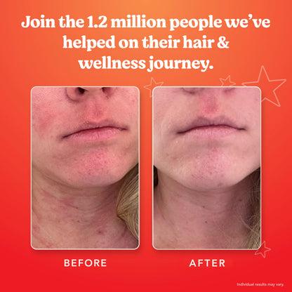 SKINtamin Vegetarian Collagen Pills | Skin Firmness, Wrinkles & Blemish Reduction