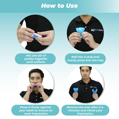 Mouth Guard for Teeth Grinding – Soft Custom-Fit Night Guard (1 Piece) – Upper or Lower