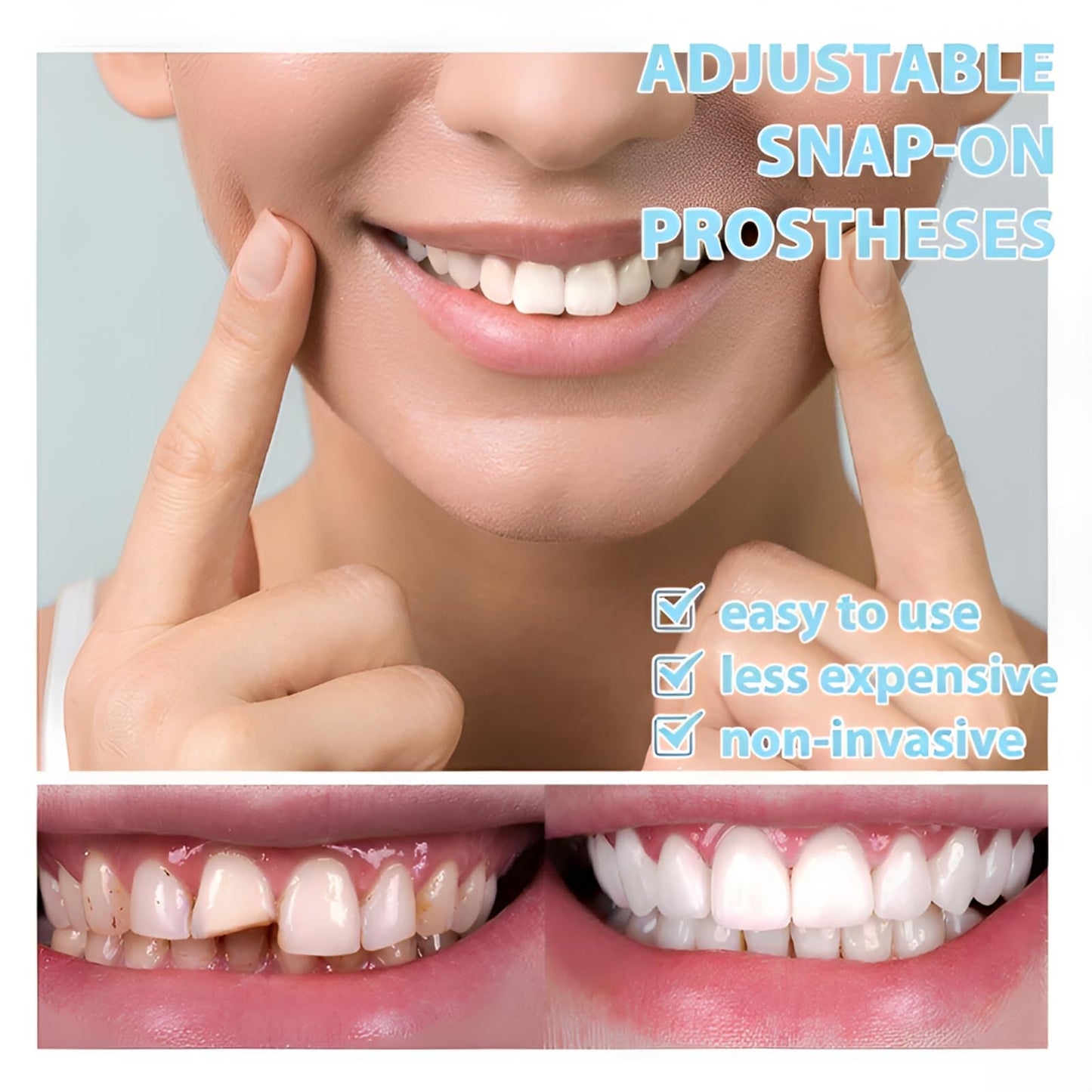 2 Pairs of Beautiful Smiles – Upper & Lower Teeth Set (Temporary Use)