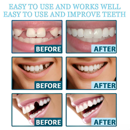 2 Pairs of Beautiful Smiles – Upper & Lower Teeth Set (Temporary Use)