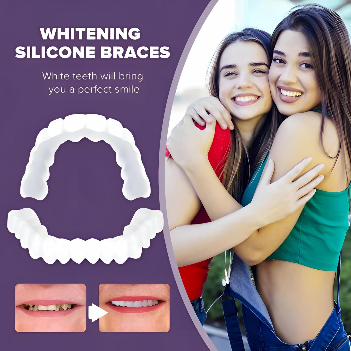 2 Pairs of Beautiful Smiles – Upper & Lower Teeth Set (Temporary Use)