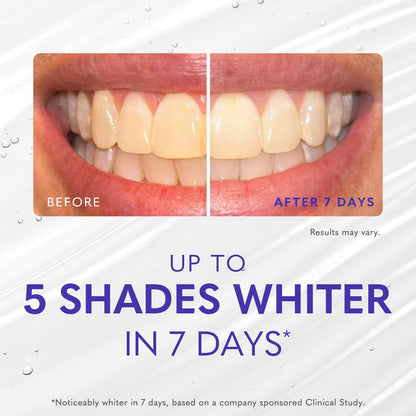 Smileactives Teeth Whitening Kit – Complete At-Home Whitening, Travel Size, 30-Day Kit