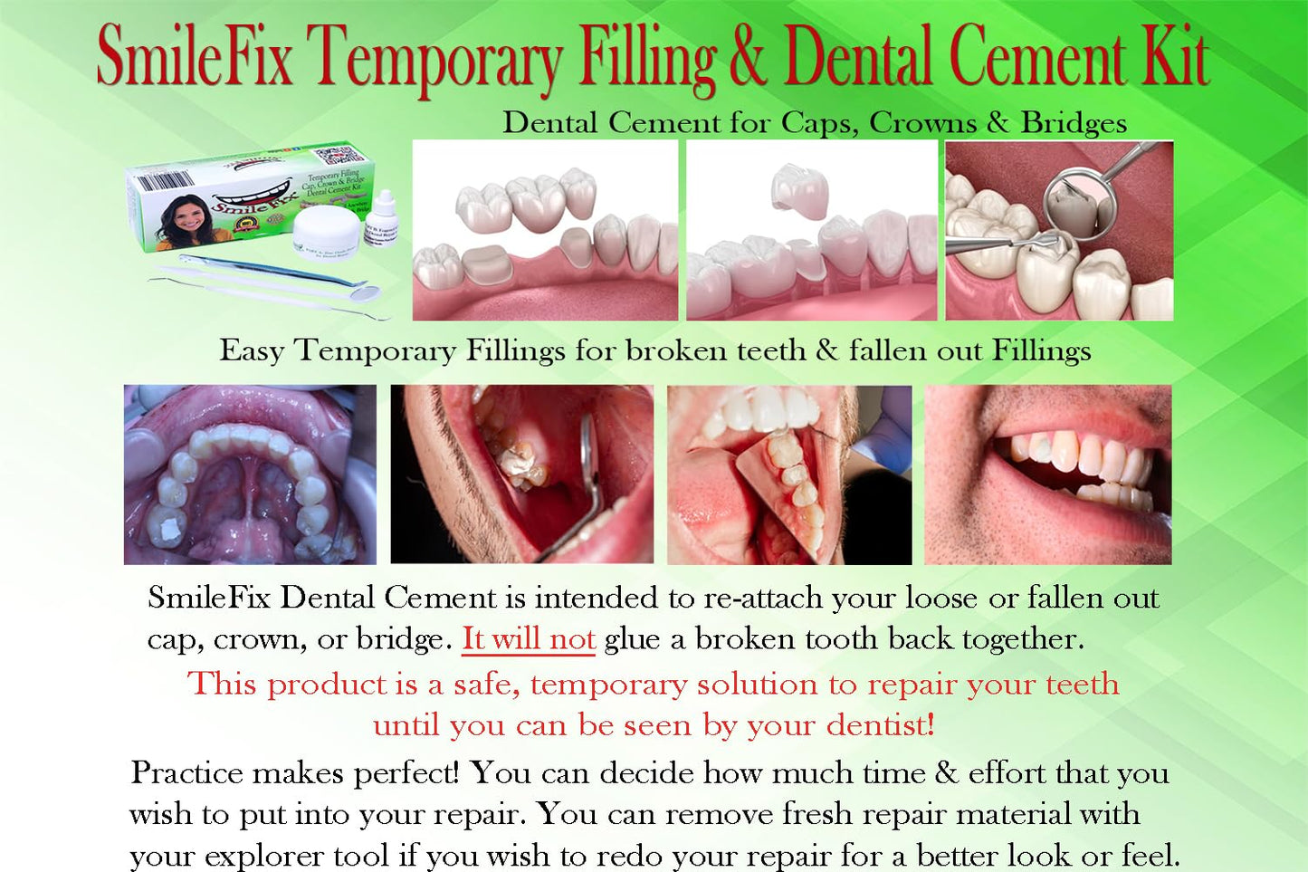 SmileFix Dental Repair Kit: Fillings, Caps, Crowns & Bridges