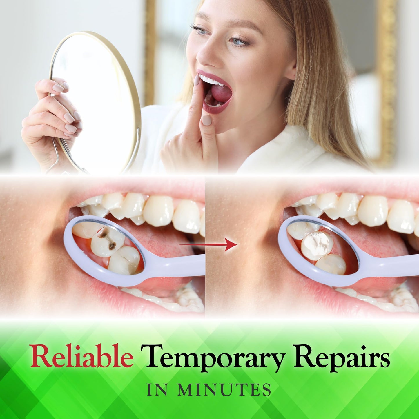 SmileFix Dental Repair Kit: Fillings, Caps, Crowns & Bridges