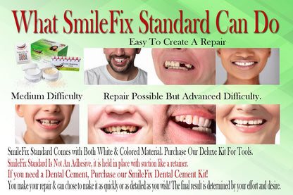 SmileFix Standard Dental Repair Kit – Color Matching Compound for Damaged Teeth
