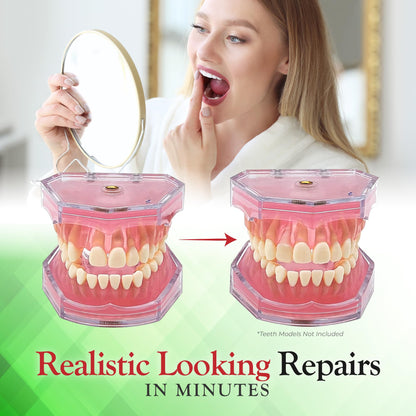 SmileFix Standard Dental Repair Kit – Color Matching Compound for Damaged Teeth