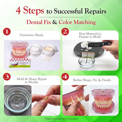 SmileFix Standard Dental Repair Kit – Color Matching Compound for Damaged Teeth