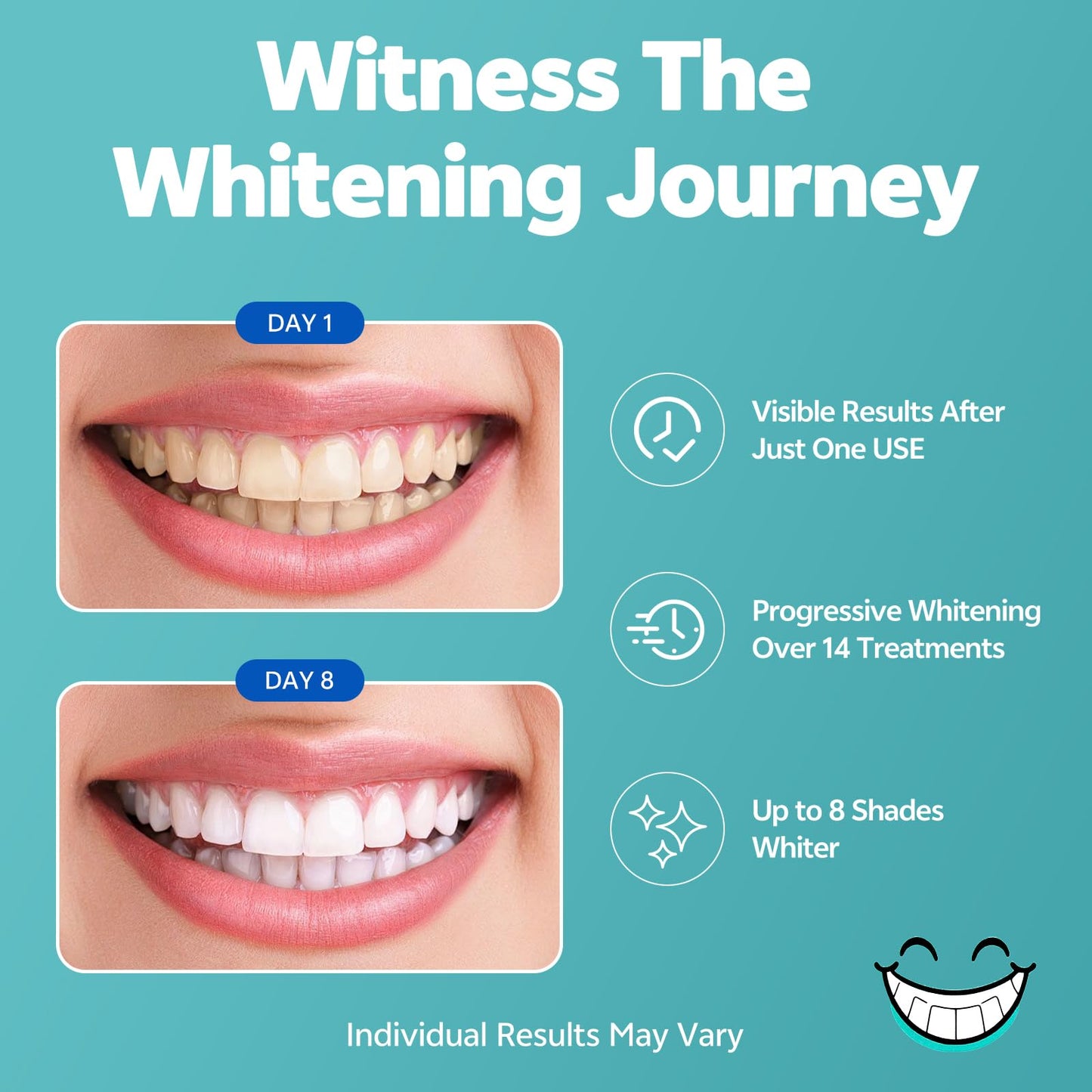 SmileFreshness Teeth Whitening Strips – 14-Day Clinically Proven Whitening with Enamel Care (Coconut)