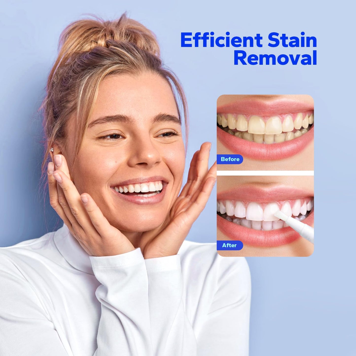 SmileShark Premium Teeth Whitening Pens (4 Count) — Sensitive-Free, Professional-Strength, On-The-Go