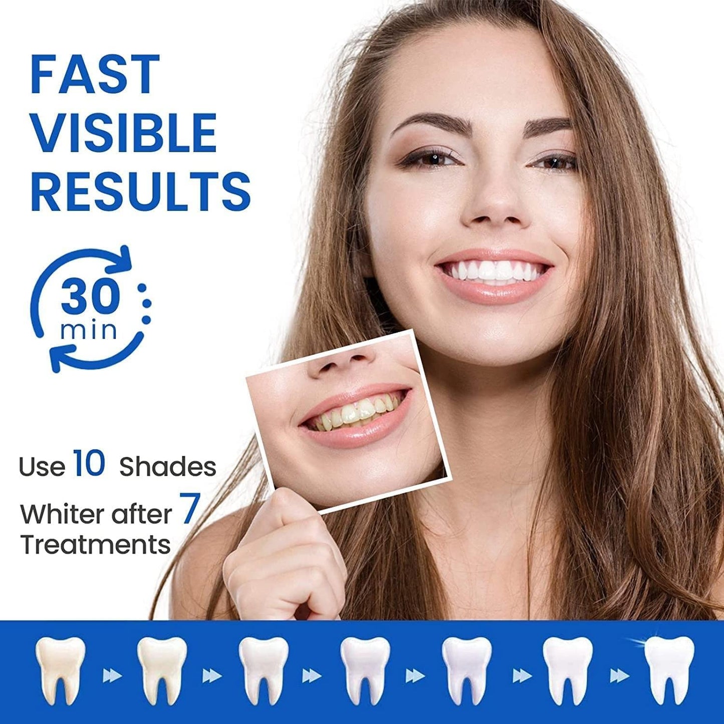 Teeth Whitening Strips – 28 Pcs, 14 Treatments, Safe for Sensitive Teeth