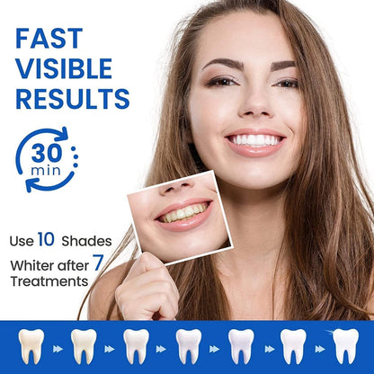 Teeth Whitening Strips – 28 Pcs, 14 Treatments, Safe for Sensitive Teeth
