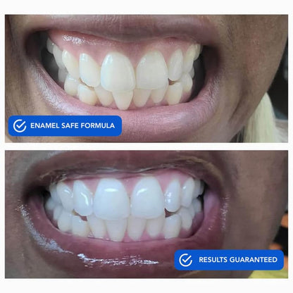 Snow DiamondSeries Whitening Strips 14 CT | Easy, Dissolvable Whitening
