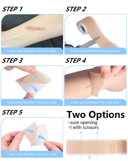Somlzu Silicone Scar Sheets | 1.6 x 60 Inch Medical Grade Roll (1.5M)