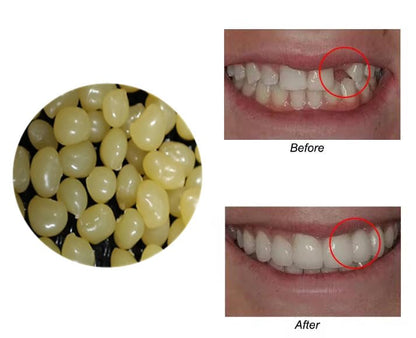 Sowsmile 4-Color Temporary Moldable Teeth Repair Beads Kit