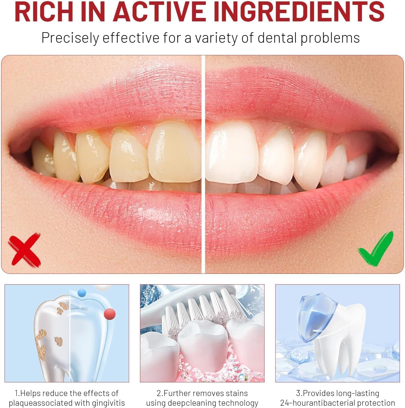 2PC SP-10 Probiotic Whitening Toothpaste – Fresh Breath, Deep Cleaning & Stain Removal (Natural Formula)