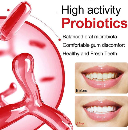2PC SP-10 Probiotic Whitening Toothpaste – Fresh Breath, Deep Cleaning & Stain Removal (Natural Formula)