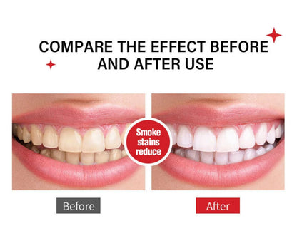 Sp-6 Ultra Whitening Toothpaste 2pcs – Probiotics, Enamel-Safe, Fluoride-Free