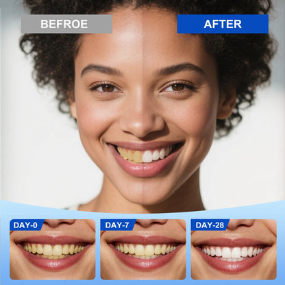 SP-6 Hydroxyapatite Toothpaste Set – 3 Tubes, Fluoride-Free, Enamel Safe, 7-Pro Probiotics Whitening