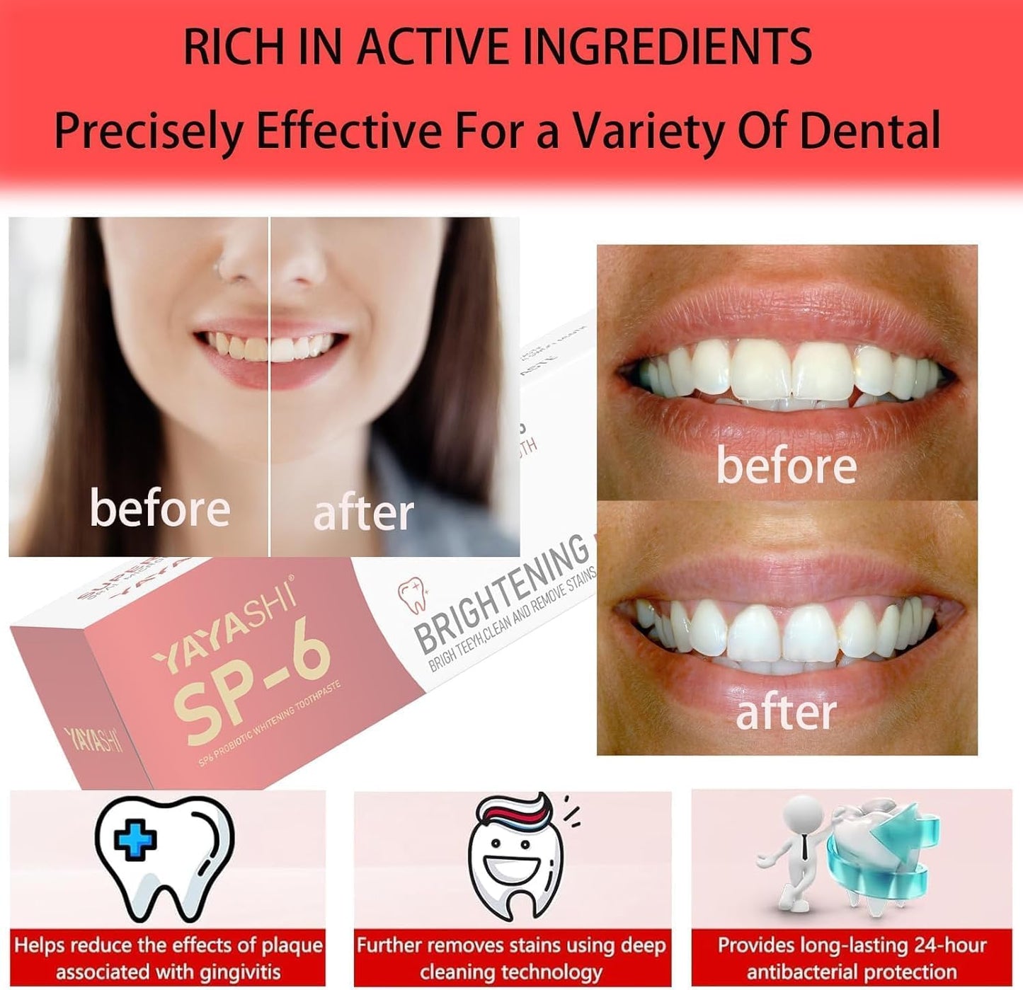2-Pack SP-6 Probiotic Whitening Toothpaste – Enamel-Safe, Fluoride-Free, Double Mint