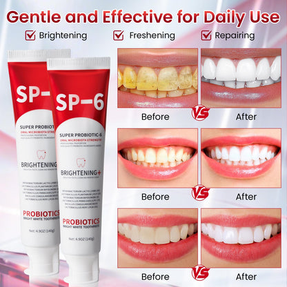 SP-6 Probiotic Whitening Toothpaste – 4.9oz, 3-Pack, Enamel-Safe, Fluoride-Free