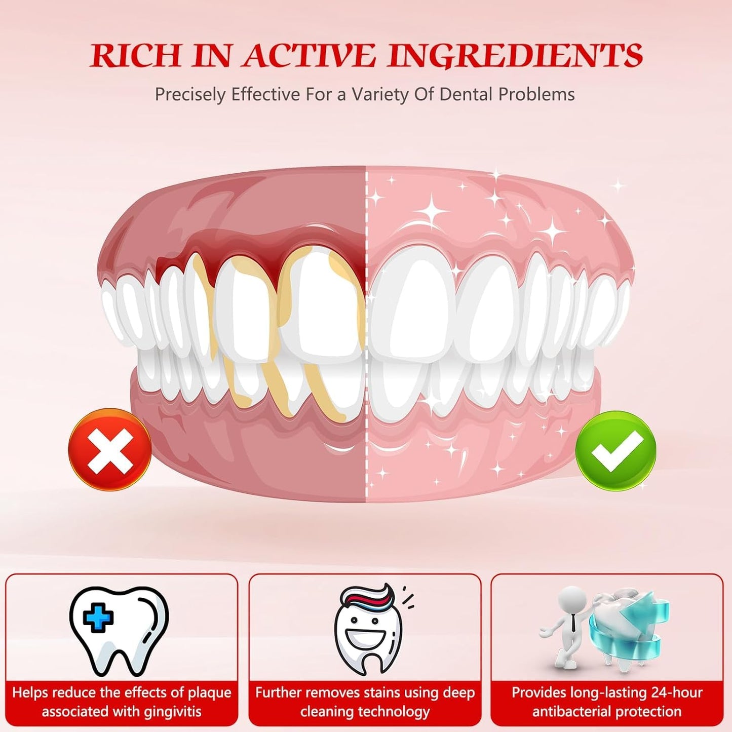 SP-6 Probiotics Whitening Toothpaste – Teeth Whitening, Gum Health, 6 Probiotics, Fluoride-Free, Minty Fresh