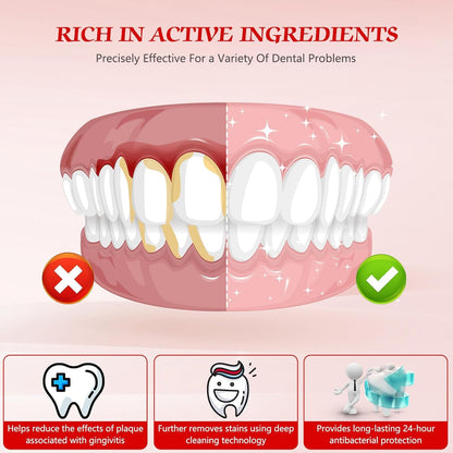 SP-6 Probiotics Whitening Toothpaste – Teeth Whitening, Gum Health, 6 Probiotics, Fluoride-Free, Minty Fresh