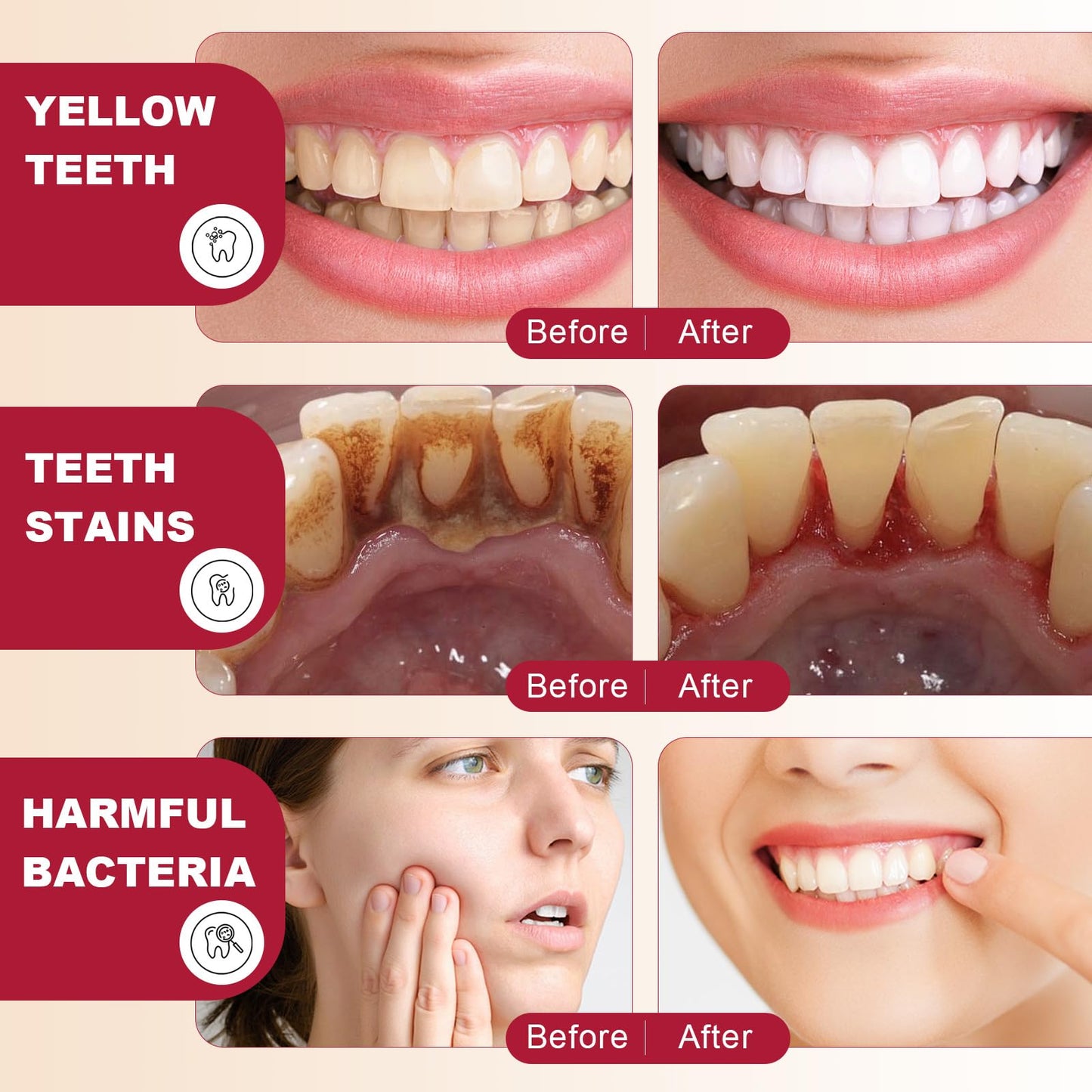 SP-6 Probiotics Whitening Toothpaste | Deep Cleaning & Fresh Breath