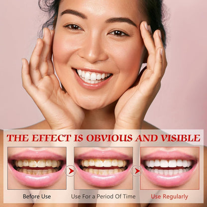 SP-6 Probiotics Whitening Toothpaste – Whitening & Gum Health, Fluoride-Free
