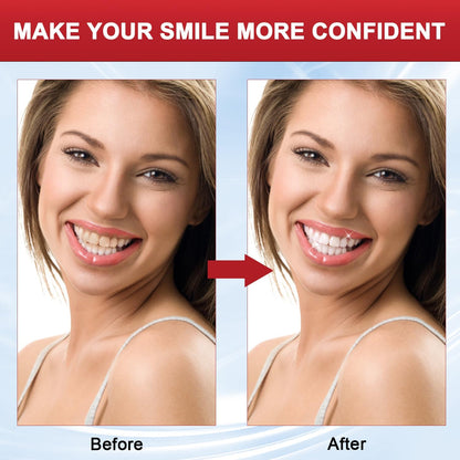 SP-8 Probiotic Toothpaste - Fresh Breath & Deep Cleaning (100g)