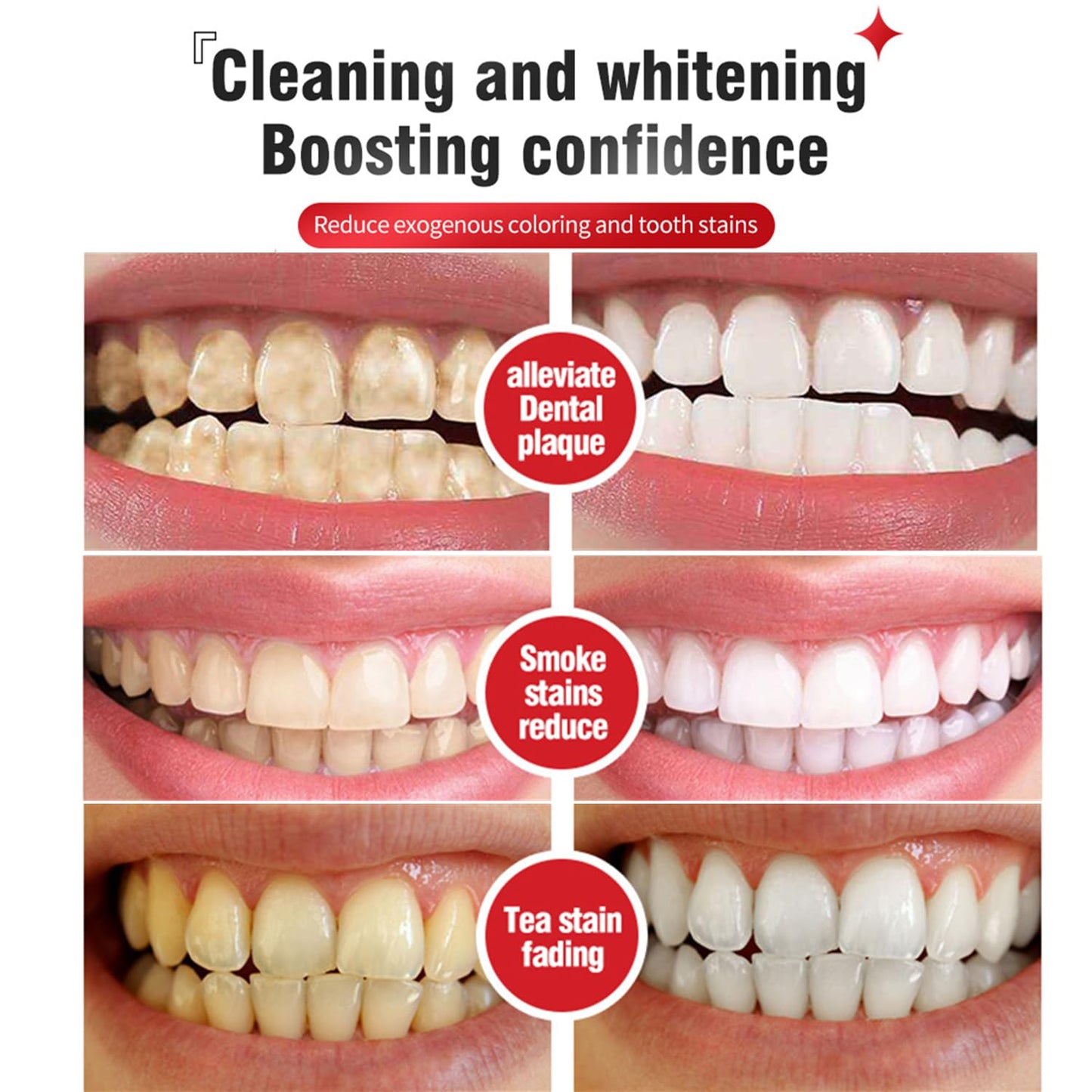 2Pcs SP-6 Probiotic Whitening Toothpaste – Fluoride-Free, Probiotic-6 Formula, Fresh Breath