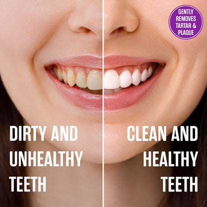 SprinJene Fluoride-Free Toothpaste for Sensitive Teeth & Gums | Black Seed Oil & Zinc | Made in USA