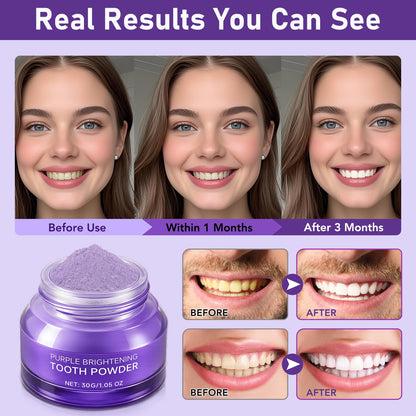 Teeth Whitening Powder – Enamel-Safe Brightening with PAP (Peroxide-Free)
