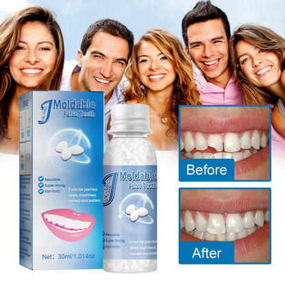 Denture Repair Kit: Moldable Beads, Tweezers & Dental Tools for Fixing Missing or Broken Teeth
