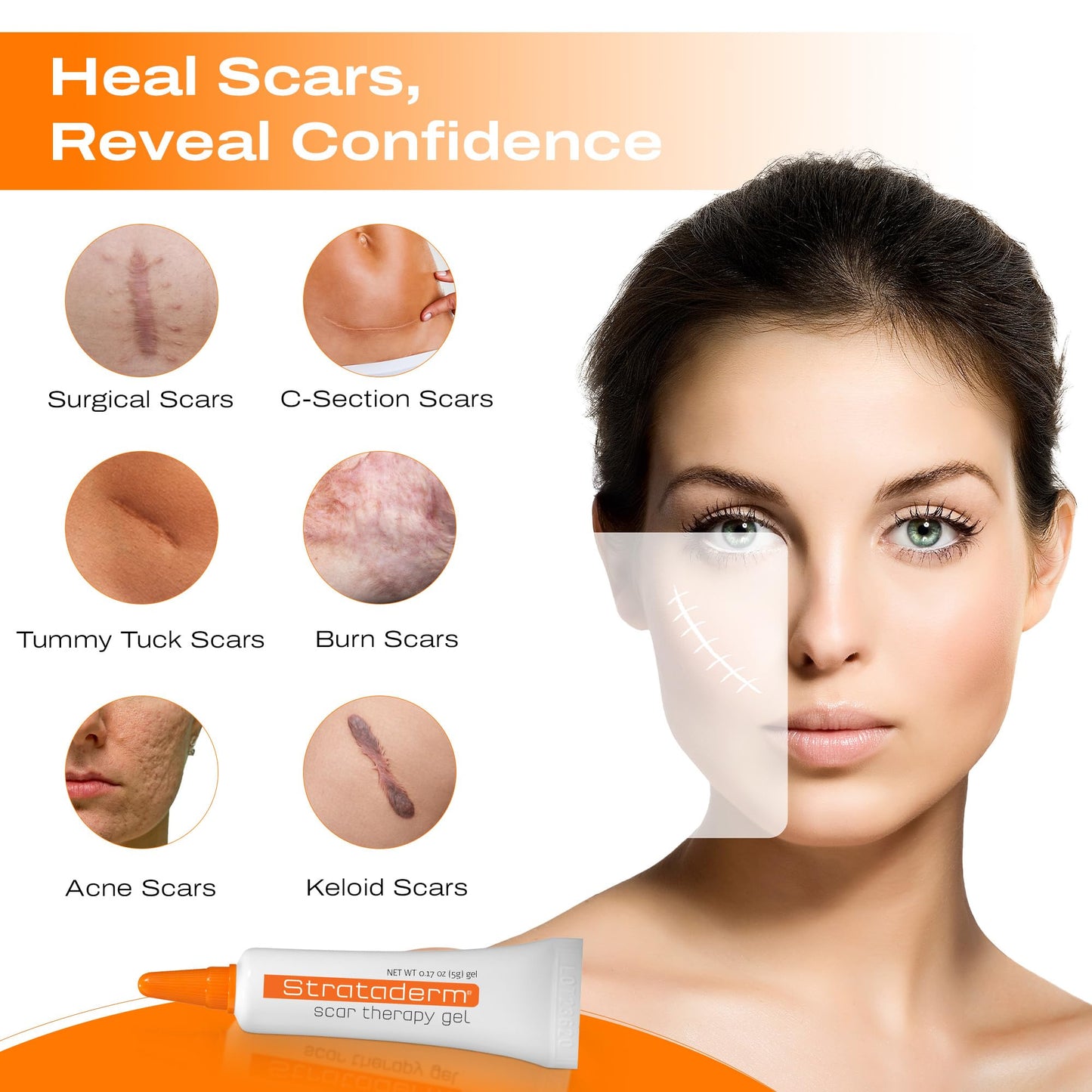 Strataderm Professional Scar Therapy Gel | Old & New Scar Care | 5g Tube