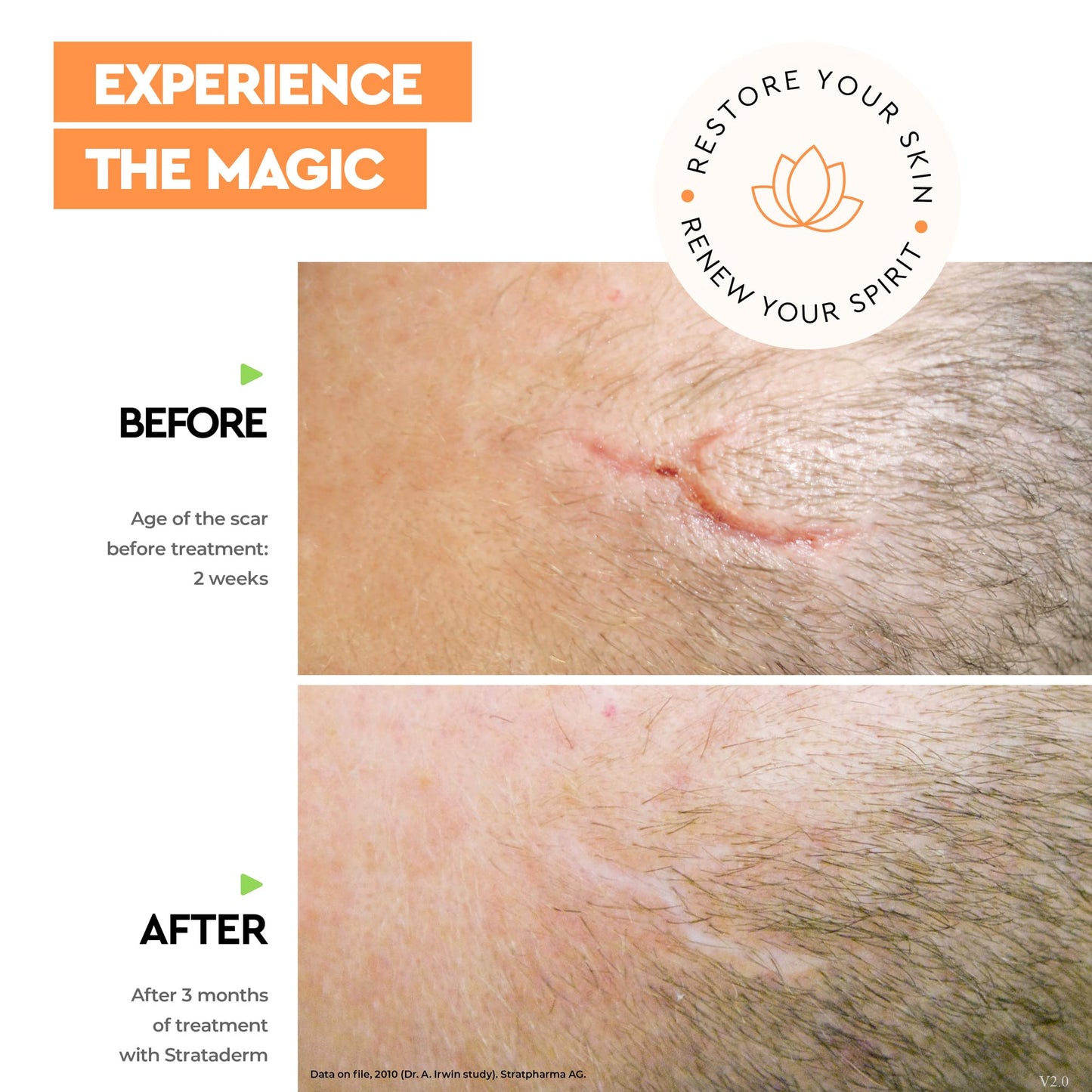 Strataderm Professional Scar Gel | For Old & New Scars, Reduces Redness & Itch