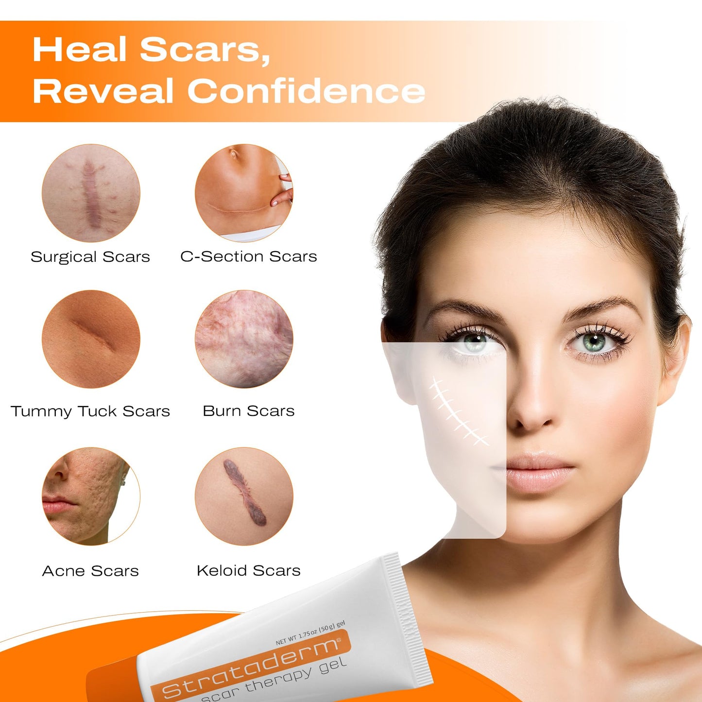 Strataderm Professional Scar Therapy Gel | For Old & New Scars | 50 g