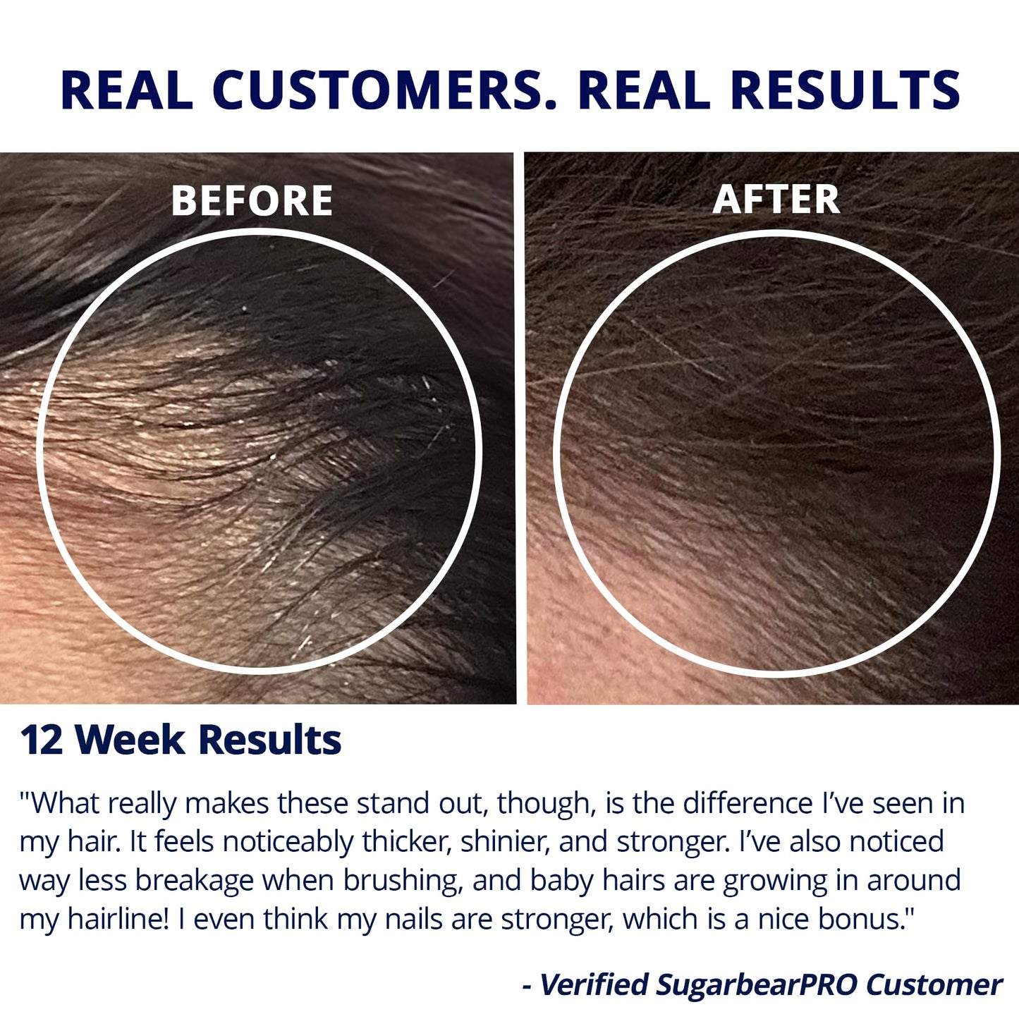 SugarBearPro Hair Vitamin Gummy - 14 Day Supply, 6000mcg Biotin, Growth for Men & Women, Vegan, Kosher, Halal, Cruelty-Free