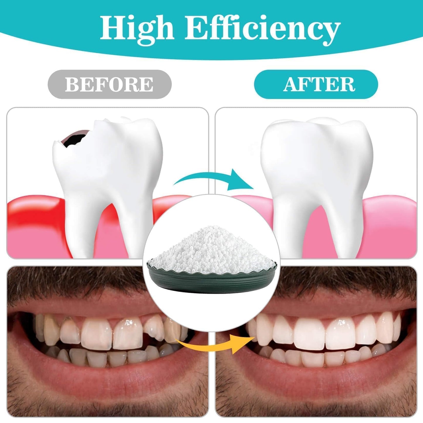 Sukh 10.9oz Moldable Thermoplastic Beads – DIY Tooth Repair Kit