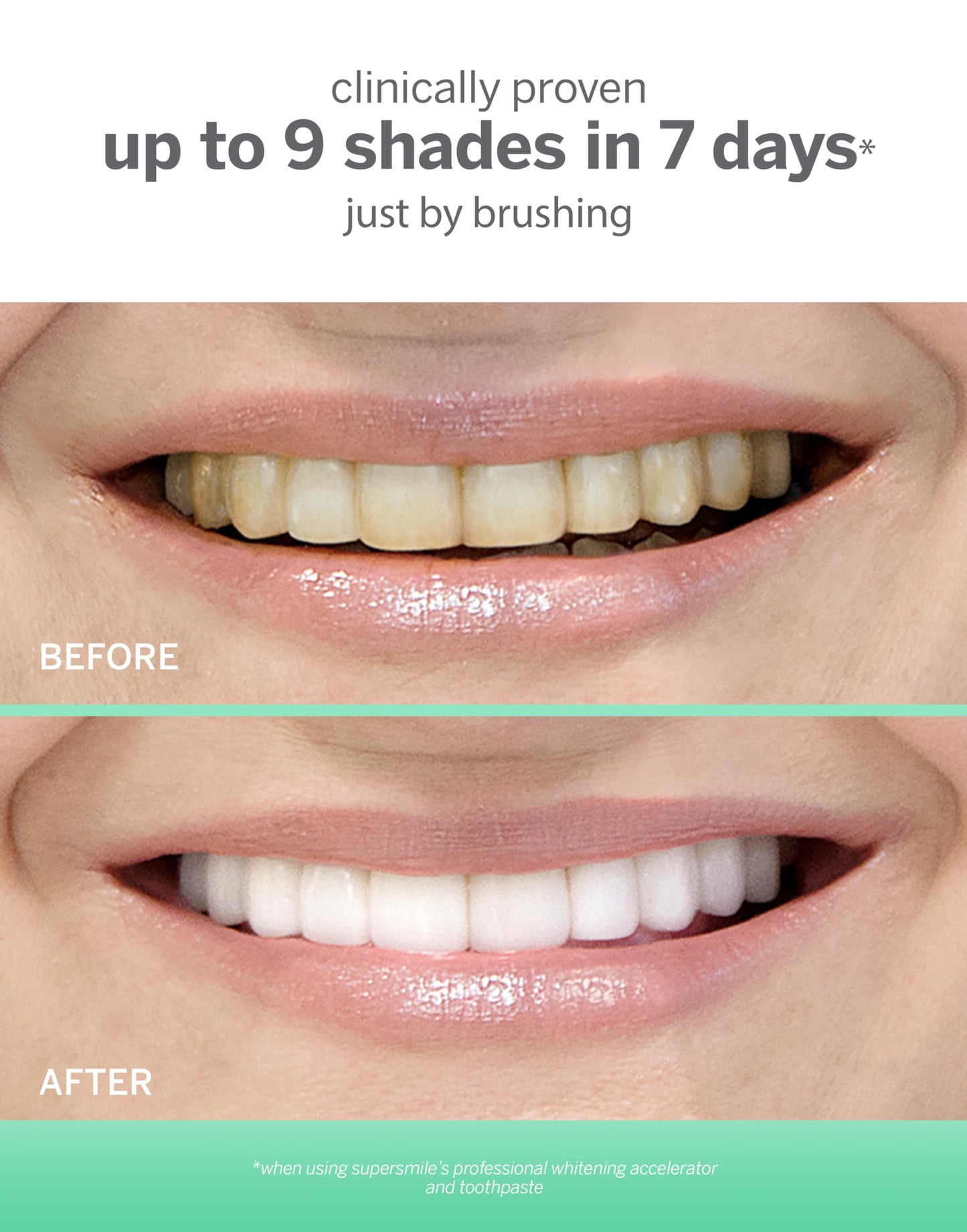 Supersmile Extra White Triple Mint Whitening Toothpaste – 7 oz