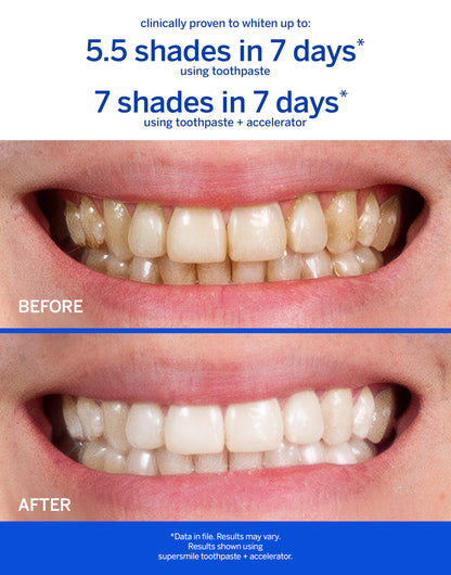 Supersmile Original Mint Fluoride-Free Whitening Toothpaste - Whitens Up to 6 Shades, 4.2 oz