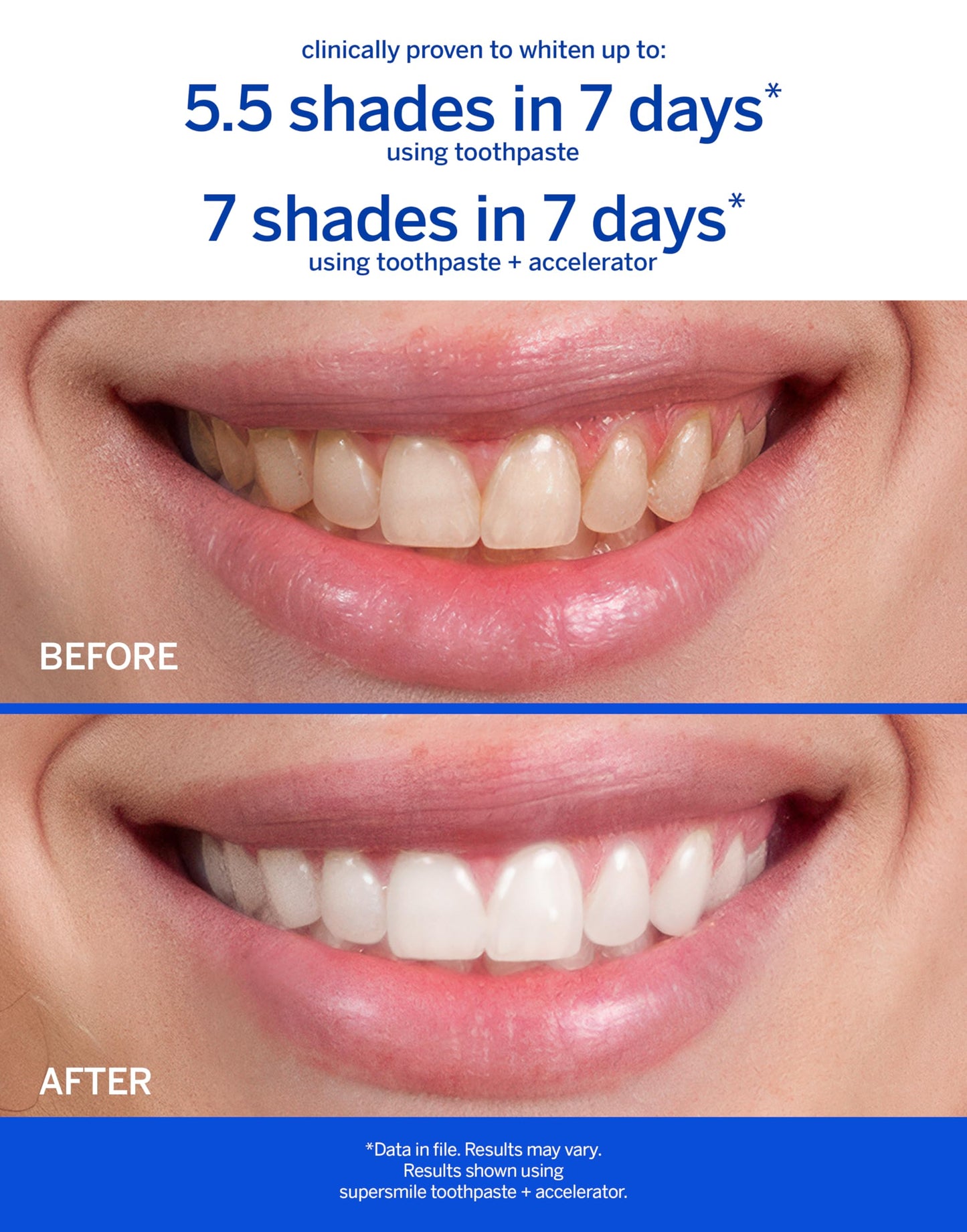 Supersmile Rosewater Mint Whitening Toothpaste with Fluoride – 8 oz | Whitens Up to 6 Shades