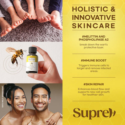 SupreH Fast-Acting Bee Venom Wart Remover – Freeze Off for Plantar & Genital Warts, 18 ml