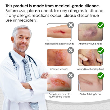 SWturK Silicone Scar Sheets Roll – Medical-Grade Scar Tape for Surgical Scars, C-Section, Tummy Tuck (1.6-in x 60-in)