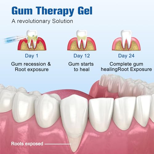 Taileden Gum Repair Therapy Gel | GumCareGel for Recessed Gums & Whitening