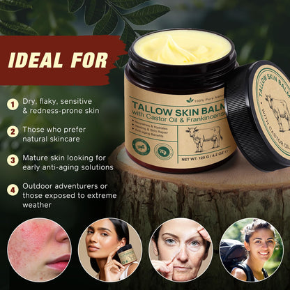 Tallow Frankincense Balm – Grass-Fed Beef Tallow + Castor Oil & Frankincense (4.2 oz)