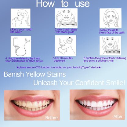 TAWEE Teeth Whitening Kit – Safe for Sensitive Teeth & Enamel, 16x Blue LED Light